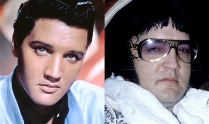 
Did Elvis Really Die Of Constipation? Find Out How The King Of Rock & Roll Died 