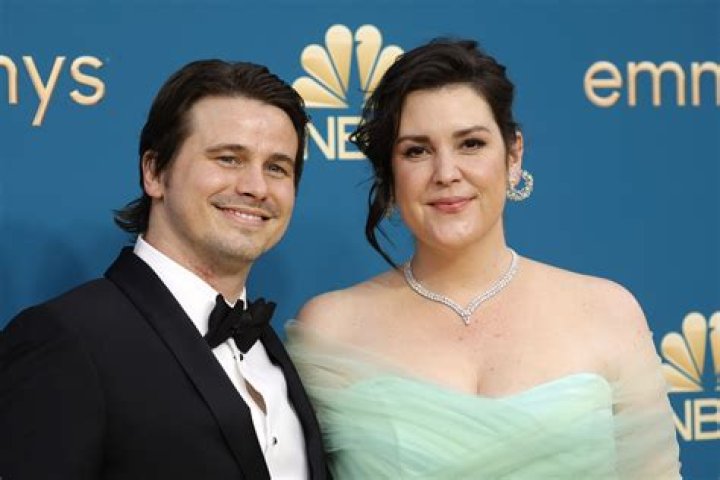 Does Shirley Henderson Have A Disability? Illness And Husband Update – Is She Married?
