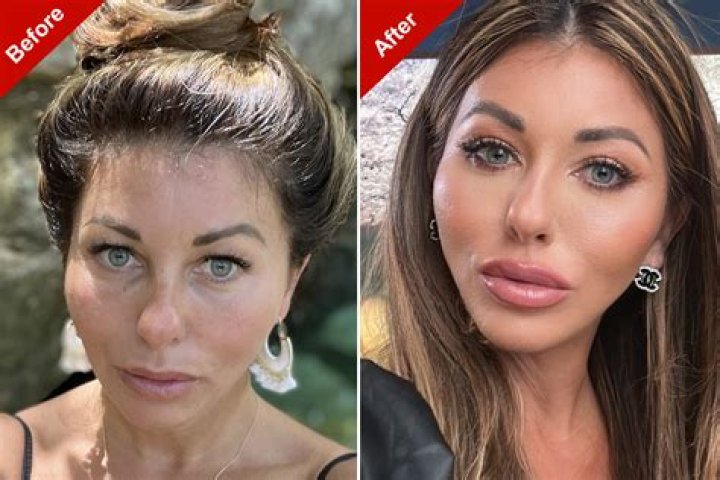 
Has Gemma Owen Done Plastic Surgery? Fans Suspect 19-Year-Old Has Lip Filler 