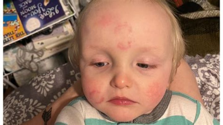 
Mississippi Daycare Employee Charged with Child Abuse After Mom Finds Bite Marks on Baby’s Arm 