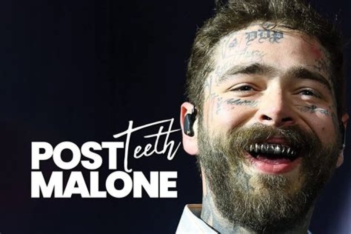 Post Malone Teeth Before And After: What Does He Have On His Teeth?